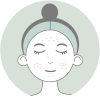痘痘肌、粉刺困擾者