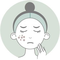 想改善痘印、暗沉膚色